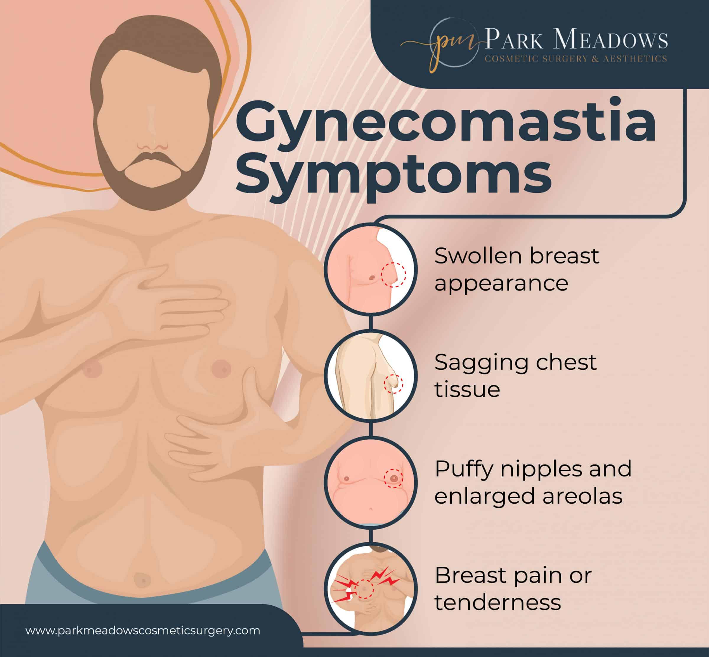 How To Tell If You Have Gyno: Understanding the Symptoms and Causes of  Gynecomastia - Salameh Plastic Surgery